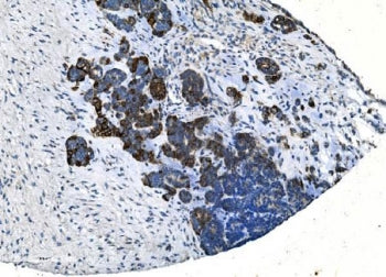 TMPRSS3 Antibody