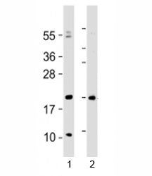 Western blot testing of Hopx antibody at 1:2000 with 1) human heart lysate and 2) mouse heart lysate