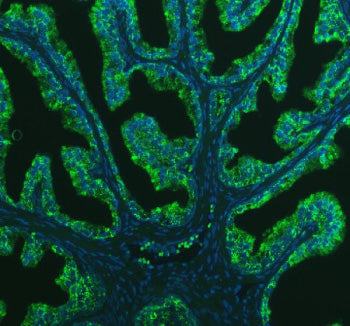 Immunofluorescent staining of BCAP29 using anti-BCAP29 antibody (green). BCAP29 was detected in a pa