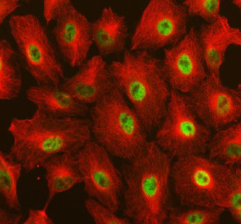 Immunofluorescent staining of RAI1 using anti-RAI1 antibody (green) and anti-Beta Tubulin antibody (