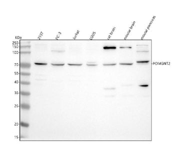 Western blot analysis of POMGNT2 using anti-POMGNT2 antibody. Lane 1: human 293T whole cell lysates,