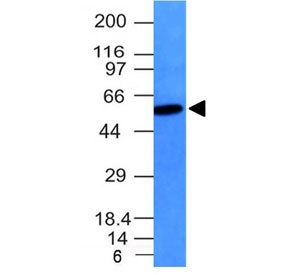 Vimentin Antibody