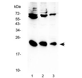 IL-2 Antibody