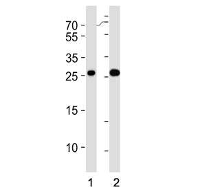 Western blot testing of human 1) Jurkat and 2) A431 cell lysate with RAB29 antibody. Predicted molec
