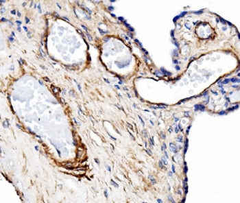 IHC staining of FFPE human placenta with PECAM-1 antibody. HIER: boil tissue sections in pH8 EDTA fo