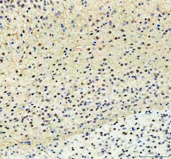 PKC beta 1 Antibody / PRKCB1