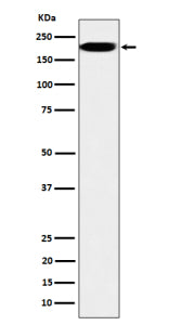 Western blot analysis of IQGAP2 expression in HepG2 cell lysate using IQGAP2 antibody. Predicted mol