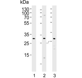 Western blot testing of human 1) KG-1, 2) MCF7 and 3) MDA-MB-453 cell lysate with FOLR2 antibody. Pr