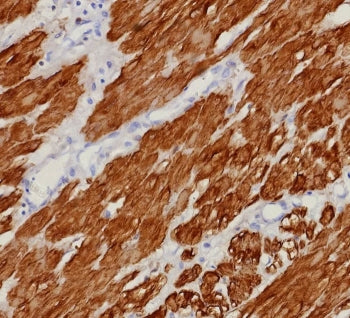 IHC staining of FFPE human uterus tissue with recombinant CNN1 antibody (clone rCNN1/9164). HIER: bo