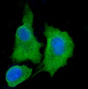 Immunofluorescent staining of FFPE human A549 cells with Aldehyde dehydrogenase 3 antibody (green) a