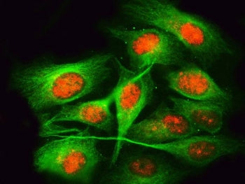 Immunofluorescent staining of FFPE human U-2 OS cells with RPRD1B antibody (red) and Beta Tubulin mA