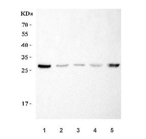 Western blot testing of 1) rat RH35, 2) mouse liver, 3) mouse lung, 4) mouse heart and 5) mouse HEPA