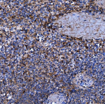 IHC staining of FFPE human spleen tissue with Septin 11 antibody. HIER: boil tissue sections in pH8