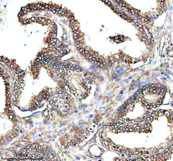 IHC analysis of PAM using anti-PAM antibody. PAM was detected in a paraffin-embedded section of huma