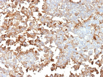IHC staining of FFPE human adrenal gland tissue with Periostin antibody (clone POSTN/4096). HIER: bo