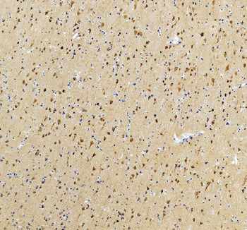 IHC staining of FFPE human brain tissue with Intersectin 1 antibody, HRP-secondary and DAB substrate