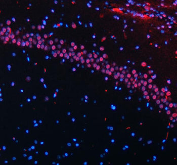 Immunofluorescent staining of FFPE rat brain tissue with HTATSF1 antibody (red) and DAPI nuclear sta