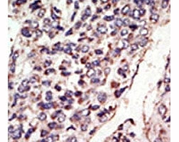 TrkC Antibody