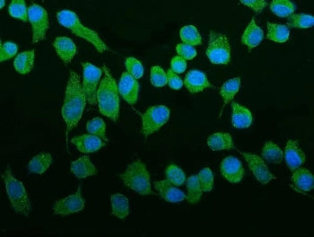 Immunofluorescent staining of FFPE human HepG2 cells with ROCK2 antibody (green) and DAPI nuclear st