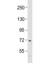 PRAM1 Antibody / PML-RARA-regulated adapter molecule 1