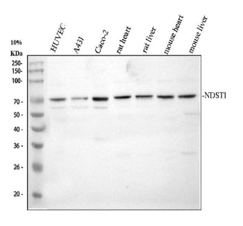 Western blot analysis of NDST1 using anti-NDST1 antibody. Electrophoresis was performed on a 10% SDS