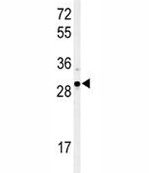 Western blot analysis of XBP1 antibody and Ramos lysate. Predicted molecular weight: ~29 kDa (isofor