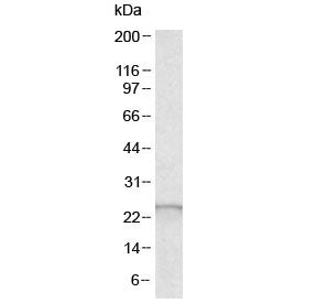 Western blot testing of human liver lysate with Glutathione peroxidase 2 antibody at 0.5ug/ml. Predi