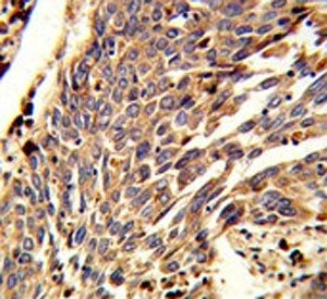 ARPC1B Antibody