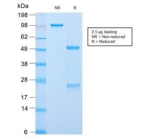 CLIP Antibody / ACTH