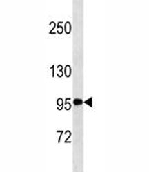 CD30 Antibody