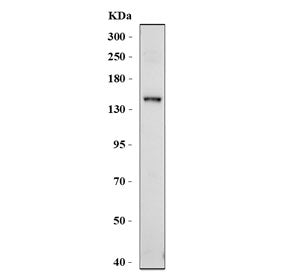 ABCB4 Antibody