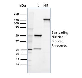 SDS-PAGE Analysis of Purified, BSA-Free CD36 Antibody (clone 185-1G2). Confirmation of Integrity and