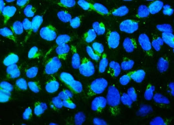 Mitofusin 1 Antibody / MFN1