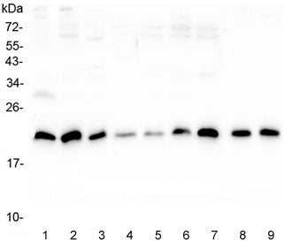 Sorcin Antibody / SRI