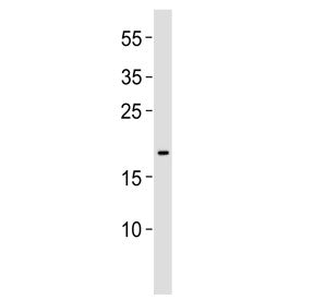 Western blot testing of human MCF7 cell lysate with EFNA1 antibody. Predicted molecular weight ~24 k