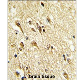 IHC staining of FFPE human brain tissue with VGluT2 antibody. HIER: steam section in pH6 citrate buf