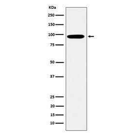 EPN1 Antibody / Epsin 1