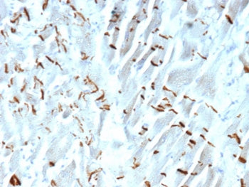 IHC staining of FFPE human heart tissue with Cadherin 2 antibody (clone CDH2/9490). HIER: boil tissu
