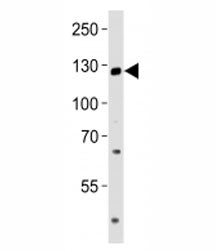 Western blot analysis of lysate from LNCaP cell line using TRPM8 antibody at 1:1000. Predicted molec