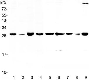 Western blot testing of human 1) HeLa, 2) placenta, 3) MCF7, 4) 22RV1, 5) rat lung, 6) rat PC-12, 7)