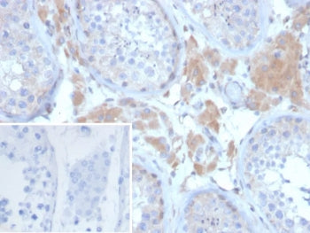GDF9 Antibody / Growth Differentiation Factor 9