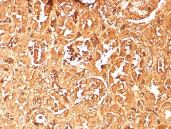 IHC staining of FFPE human kidney tissue with recombinant HBAa antibody (clone rHBA/9167). HIER: boi