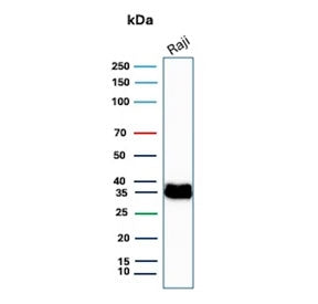 Western blot testing of human Raji cell lysate with CD74 antibody. Expected molecular weight: 33-43