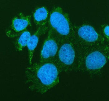 Immunofluorescent staining of FFPE human Caco-2 cells with SIAE antibody (green) and DAPI nuclear st