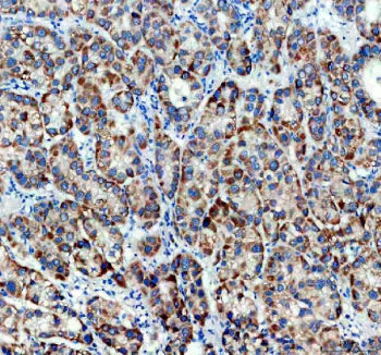 Immunohistochemical staining of TIMM50 using anti-TIMM50 antibody. TIMM50 was detected in a paraffin