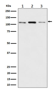 Western blot analysis of Meckelin/TMEM67 expression in (1) human MCF7 cell lysate; (2) mouse RAW 264