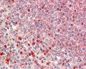 IHC testing of FFPE human spleen with UBR4 antibody at 5ug/ml. HIER: steamed with pH6 citrate buffer