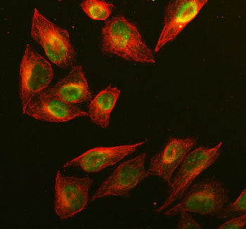Immunofluorescent staining of RAD51AP1 using anti-RAD51AP1 antibody (green) and anti-Beta Tubulin an