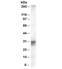 FHL1B Antibody / SLIMMER