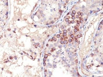IHC analysis of formalin-fixed, paraffin-embedded human testis stained with MAGE-1 antibody (clone M